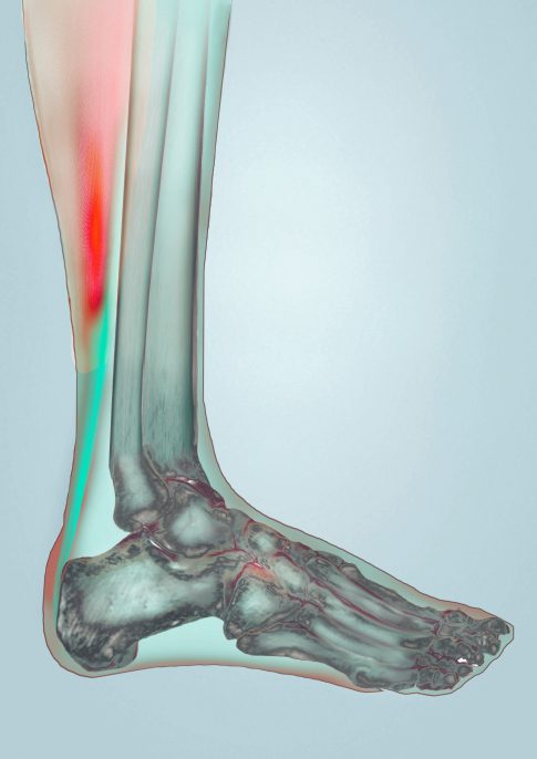 A 3D illustration of the inner structure of a foot.