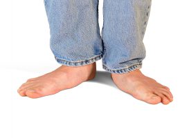 A closeup photo of a person's flat feet.